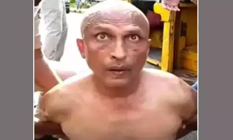 Viral Video: Anaesthetist beaten on road by police, sent to mental hospital