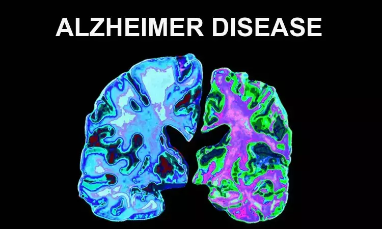 Anticholinergic drugs linked to increased risk of Alzheimers disease: Study