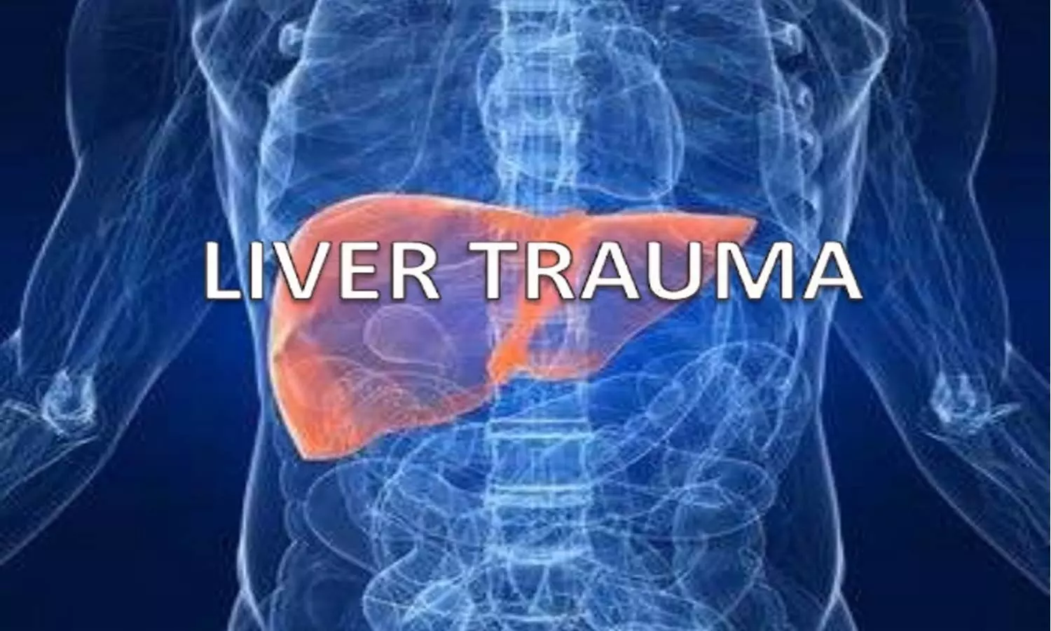 Operative and Nonoperative management of Liver Trauma: WSES Guidelines