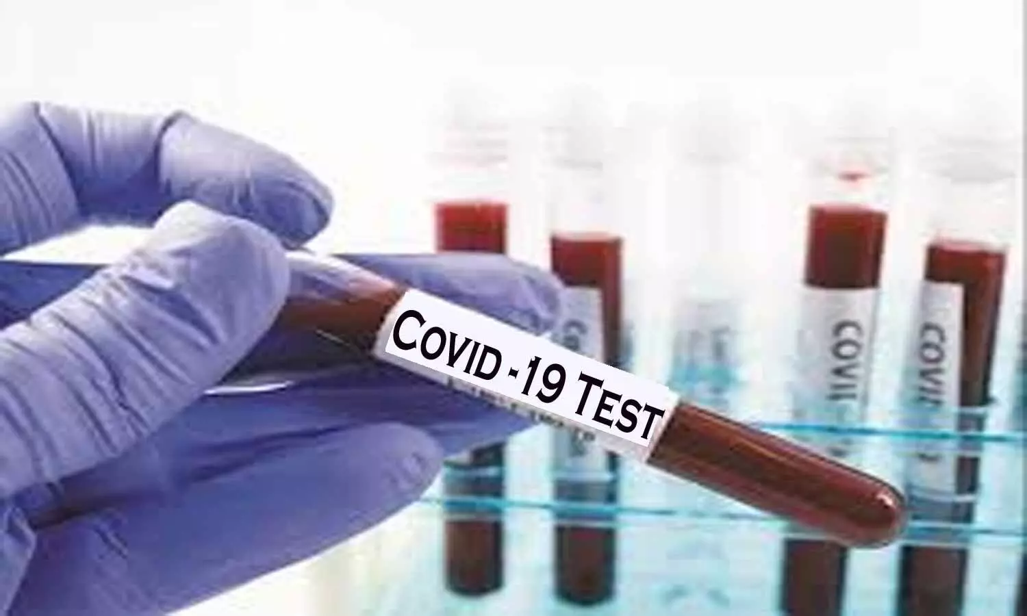 COVID 19 tests: Maha govt drafts up panel to fix charges at private labs