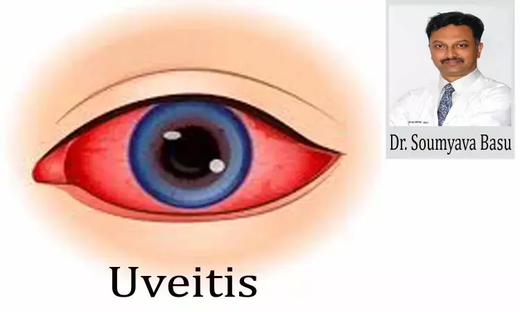 New research to make uveitis treatment more effective