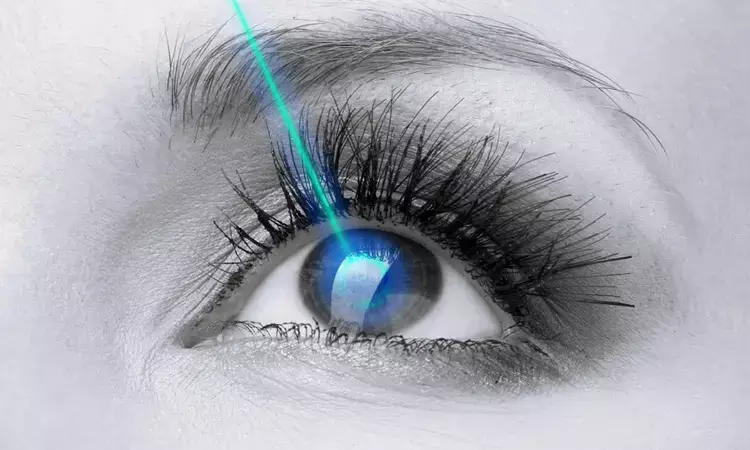 YAG laser peripheral iridotomy not tied to significant corneal endothelial damage: RCT