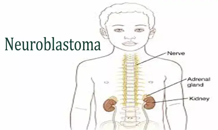 Rare case of Neuroblastoma presenting with torticollis- A report