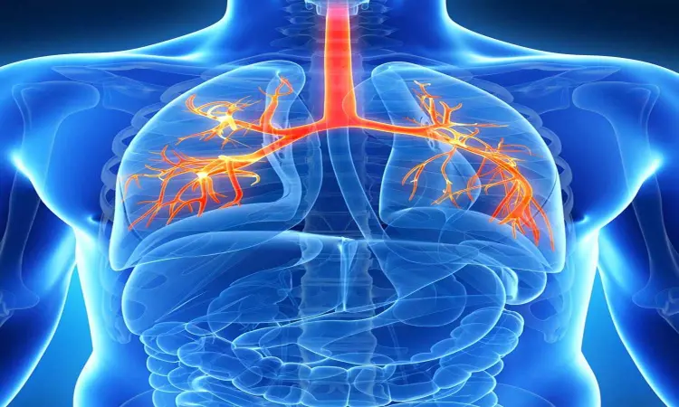 Tobramycin inhalation may decrease flares of non-cystic fibrosis bronchiectasis: Study