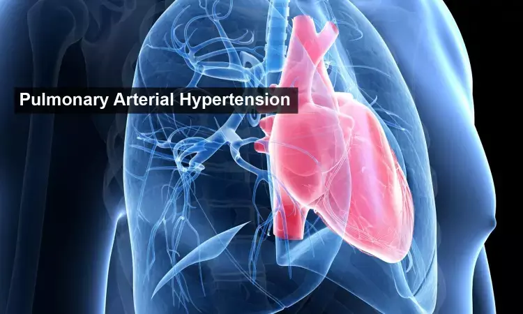 Study details HIV-associated pulmonary arterial hypertension and its impact on HIV management