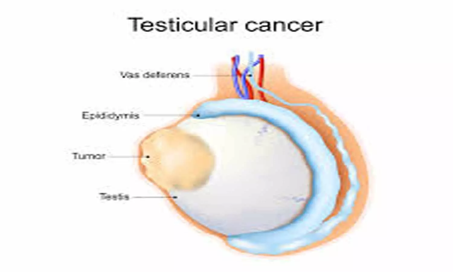 Medical imaging may increase risk of testicular cancer: Study