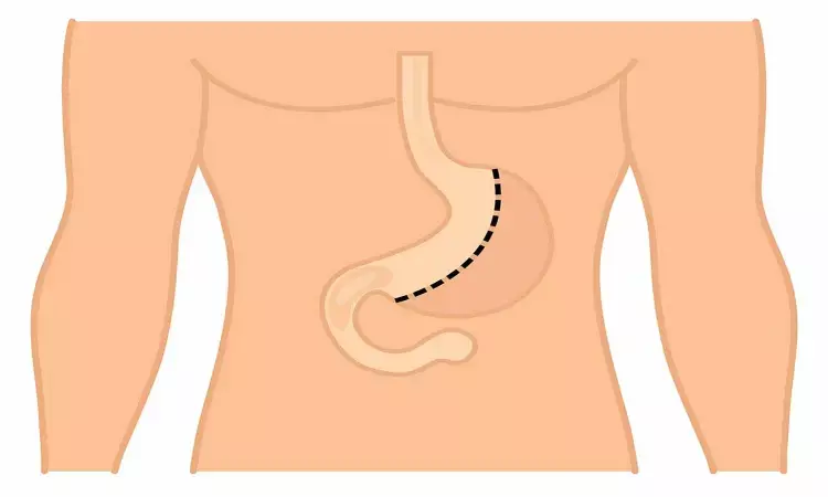 Patients with advanced proximal gastric cancer located at posterior gastric wall may benefit from LSTG