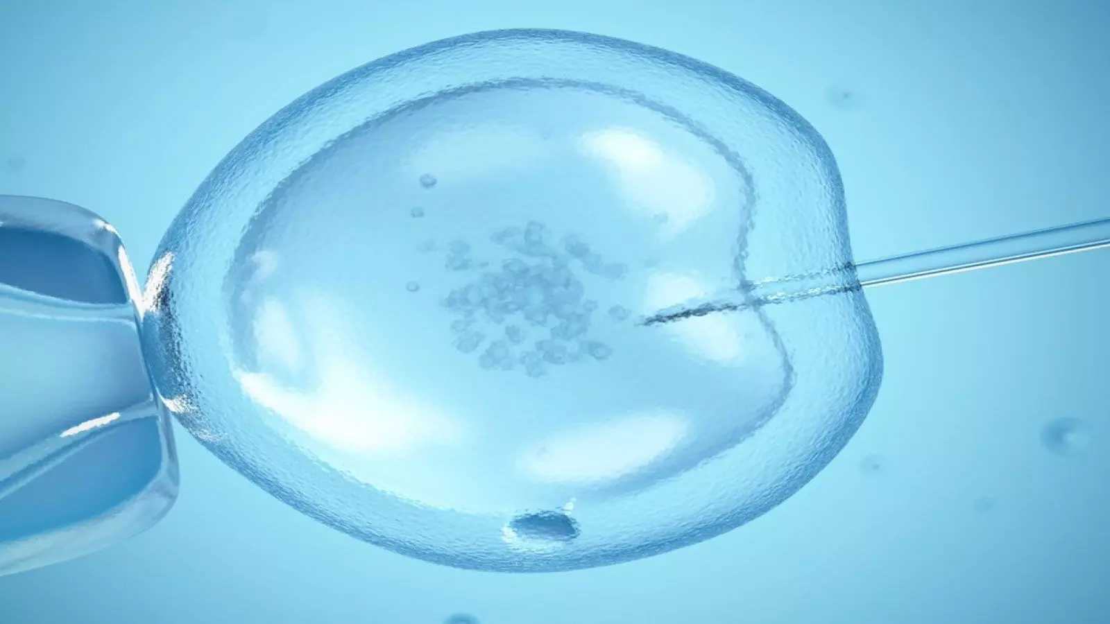Endometrial scratch of no value to first-time IVF patients finds clinical trial