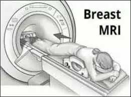 Breast MRI can predict success of preop chemotherapy in inflammatory breast cancer patients: Study