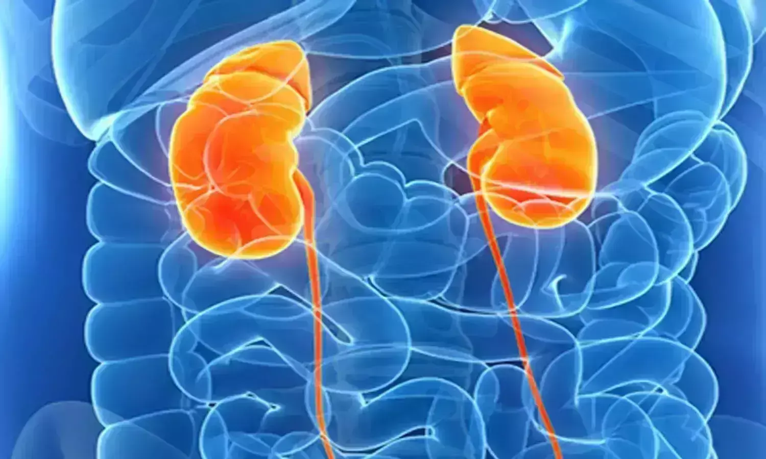 Cytoreductive Nephrectomy beneficial in metastatic renal cell carcinoma: Study