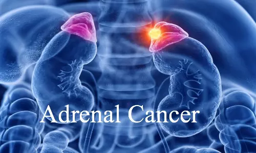Simple urine test could improve detection of adrenal cancer significantly:  Lancet