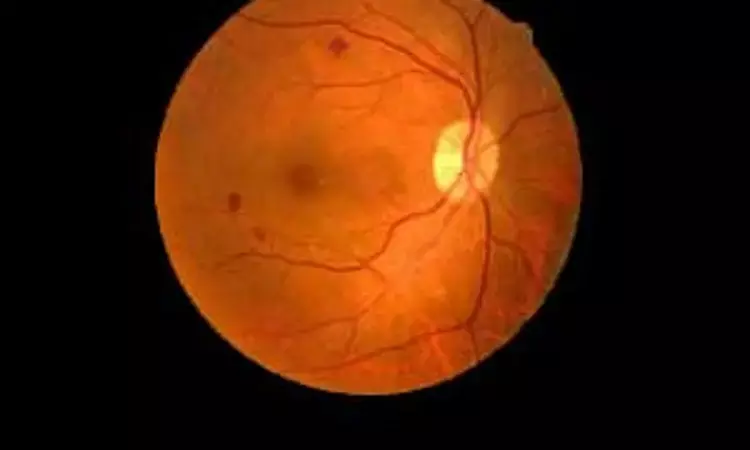 Double protocol therapy effectively improves visual acuity in Diabetic macular edema