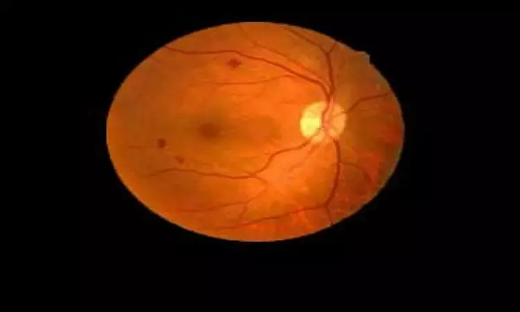 Fluocinolone acetonide implant effective in treating diabetic macular edema: BMJ