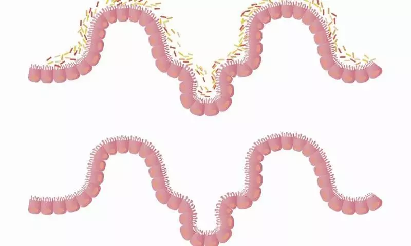 Penile microbiota linked to bacterial vaginosis among females: Study