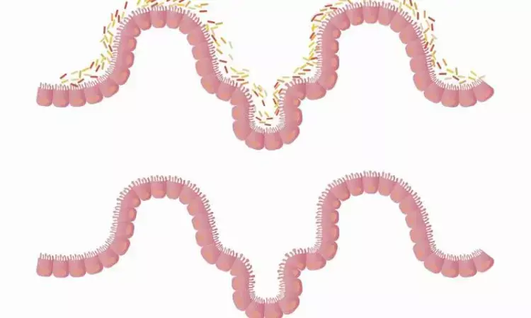 Penile microbiota linked to bacterial vaginosis among females: Study