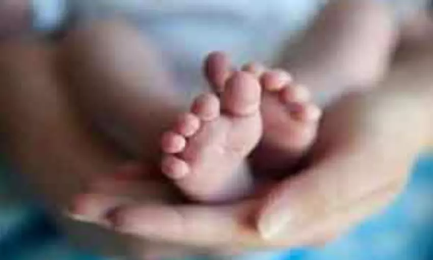 Mizoram: Doctors successfully separate conjoined twins at Zoram Medical College