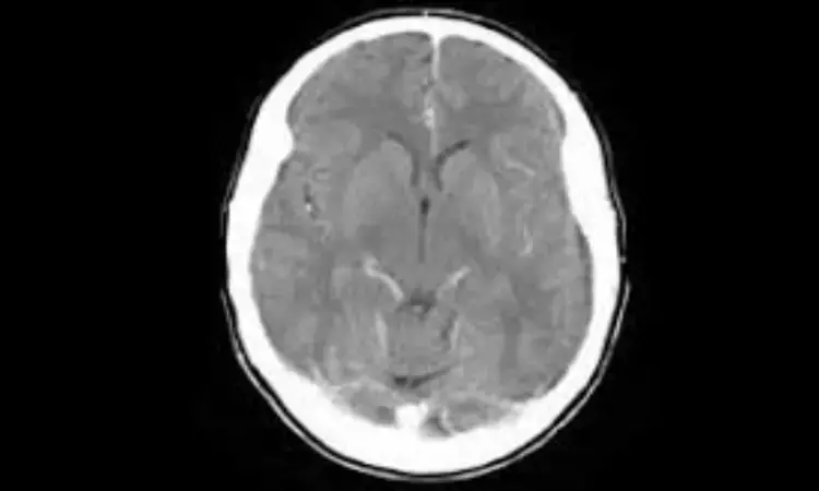 Acute Treatment of Cerebral Edema in Neurocritical Care Patients: NCS guidelines