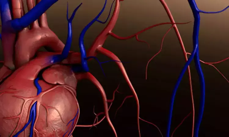 Intravascular ultrasound Guided PCI may lower risk of death, heart attack: JACC