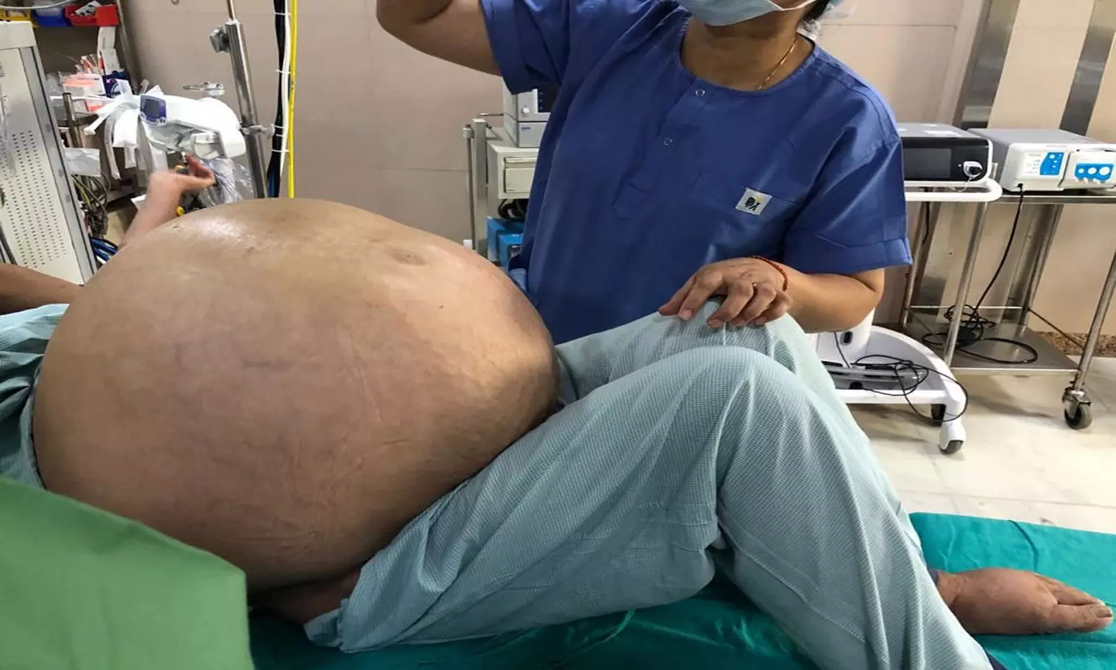 Indraprastha Apollo Hospital doctors successfully remove Worlds Largest Ovarian Tumour weighing 50 Kgs
