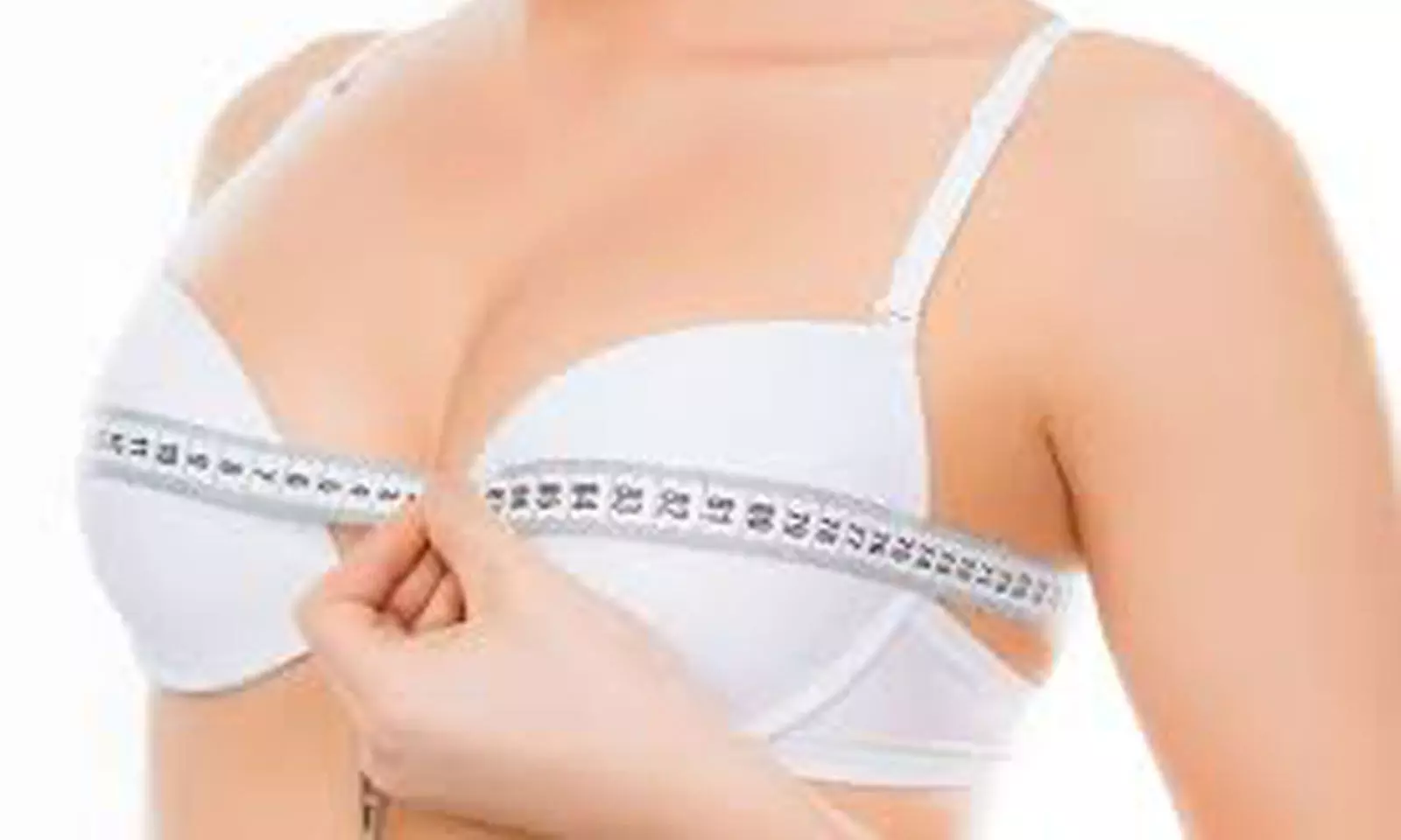 Aesthetic outcomes of implant-based breast reconstruction stay long term: Study