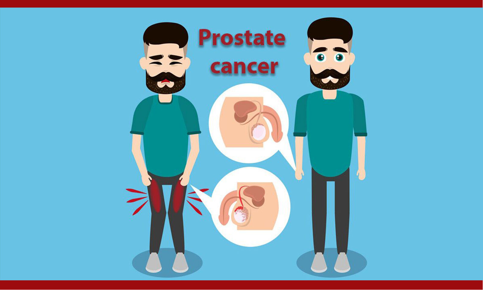 What are the signs of prostate cancer