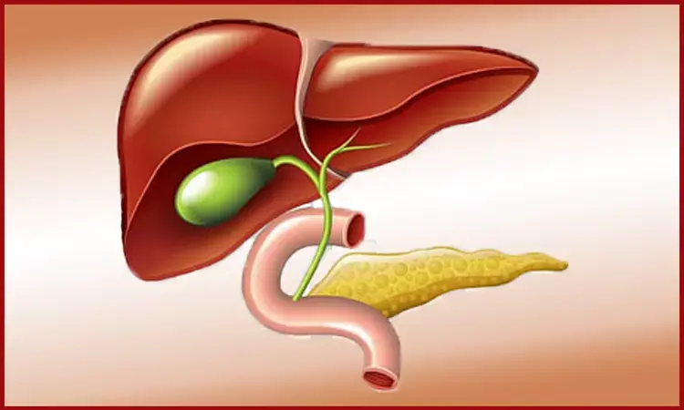 Gastric ectopic pancreas found during a bariatric surgery procedure- Case study