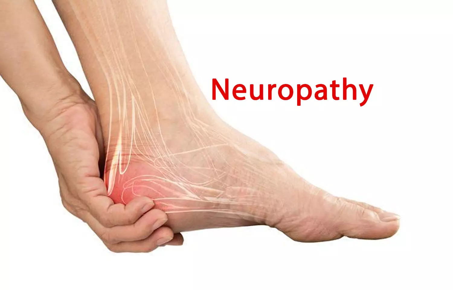AAN Issues Guideline for Treatment of Painful Diabetic Neuropathy