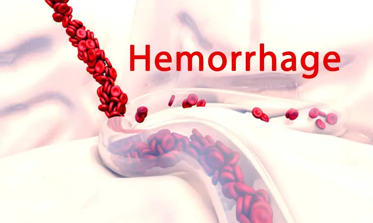 Visible hydrogels may monitor and  rapidly control hemorrhage: Study