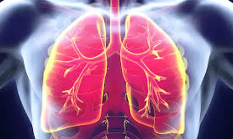 All high risk surgery patients must be screened early for perioperative pulmonary embolism