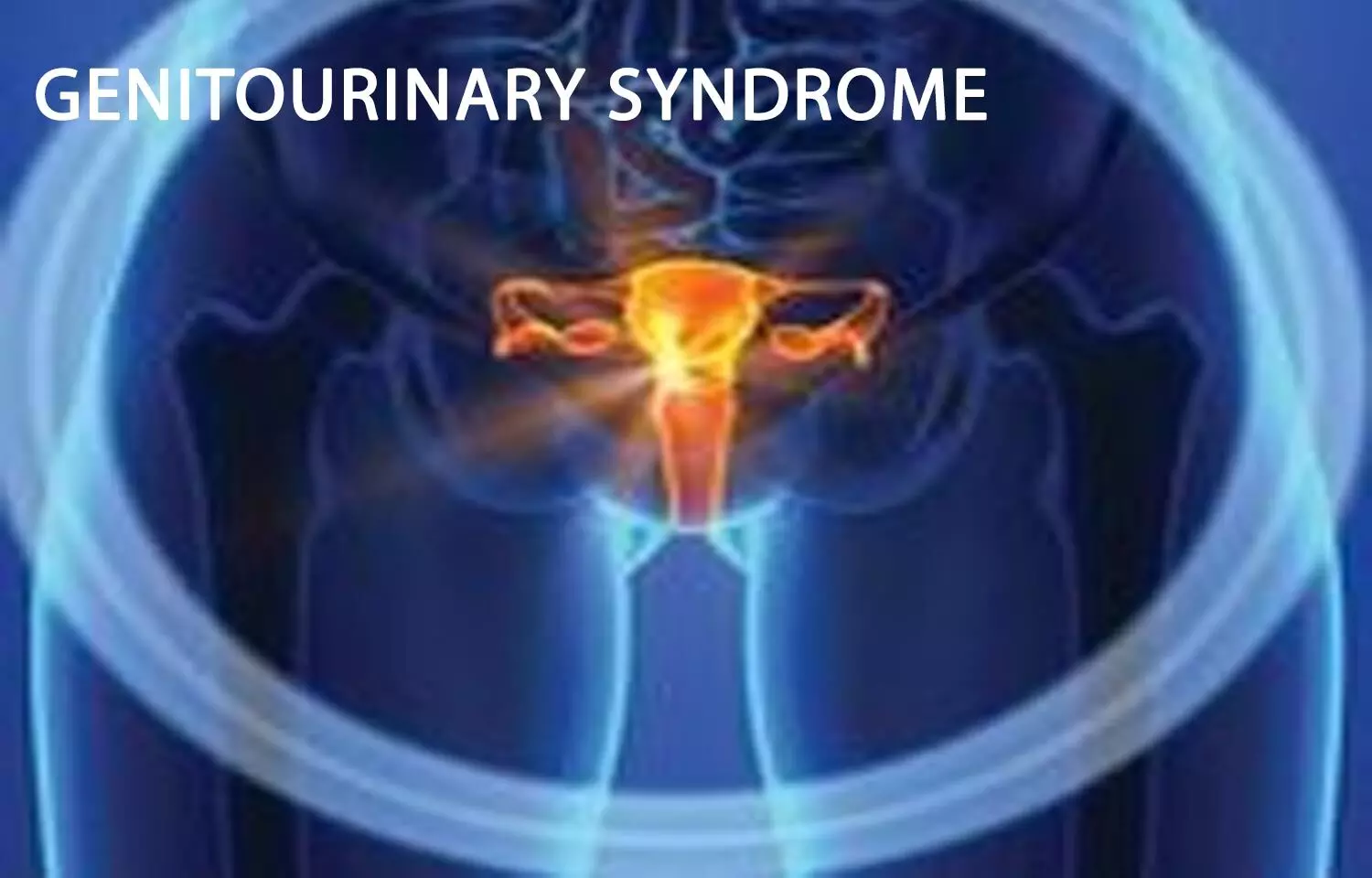 New Position Statement on Genitourinary syndrome released by NAMS