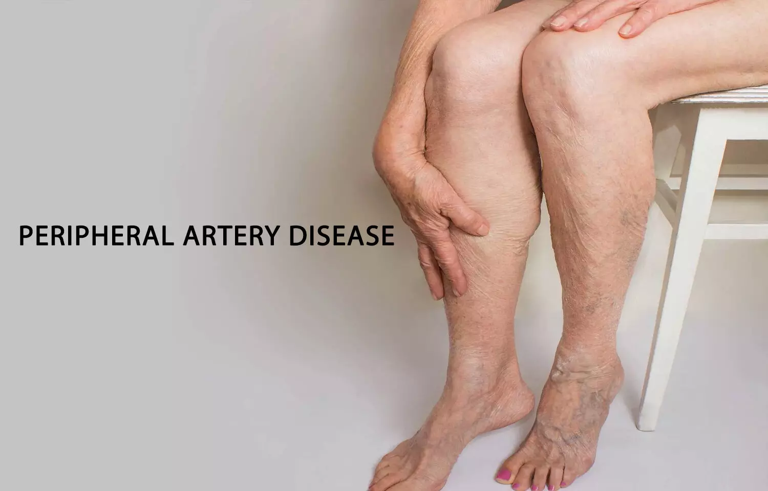 Peripheral artery disease