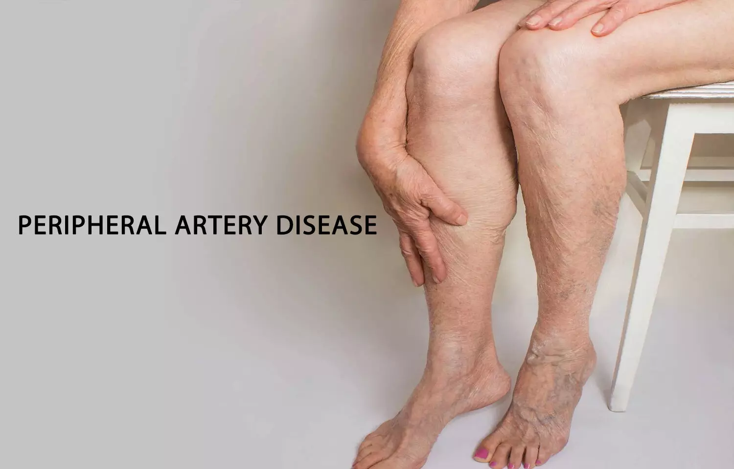 Disease peripheral artery Peripheral Vascular