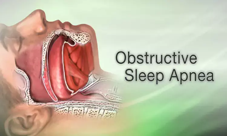 Sleep Apnea may be additional risk in COVID-19 patients, finds study