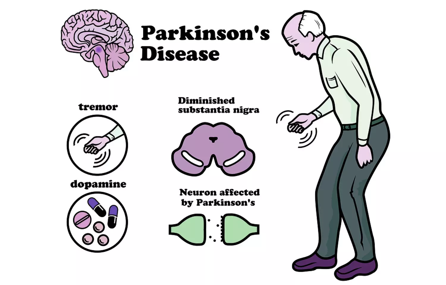 Disease symptoms parkinson Early symptoms