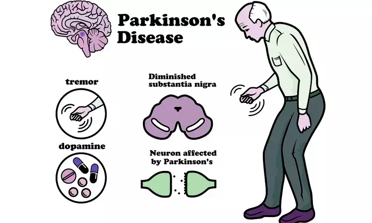 Prostate drug associated with lower risk of Parkinsons disease