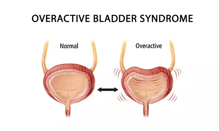 Novel Renova iStim is effective for Overactive Bladder Syndrome