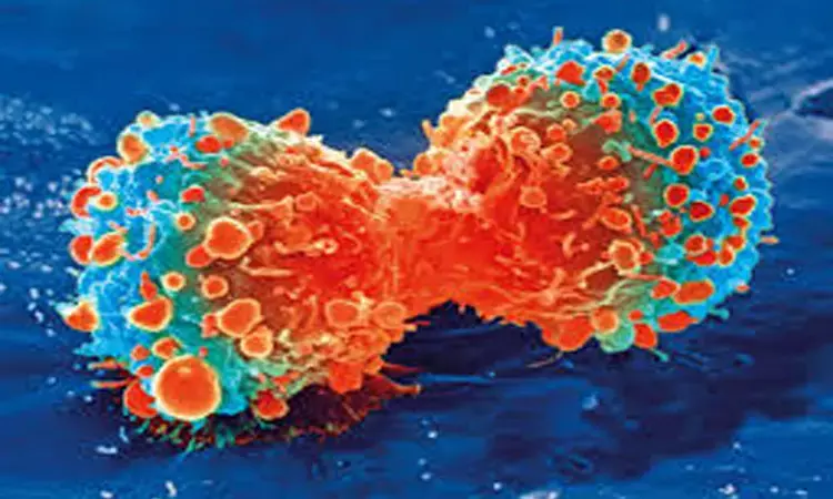 Targeted drug shows activity against brain metastases in kidney cancer