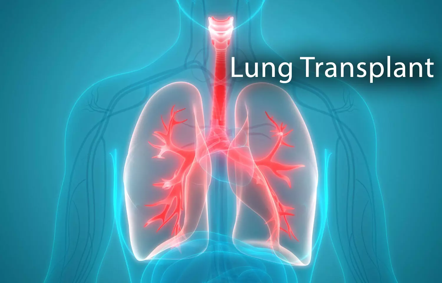 Recipient of lung transplant dies after receiving COVID-19 infected lungs: Case Report