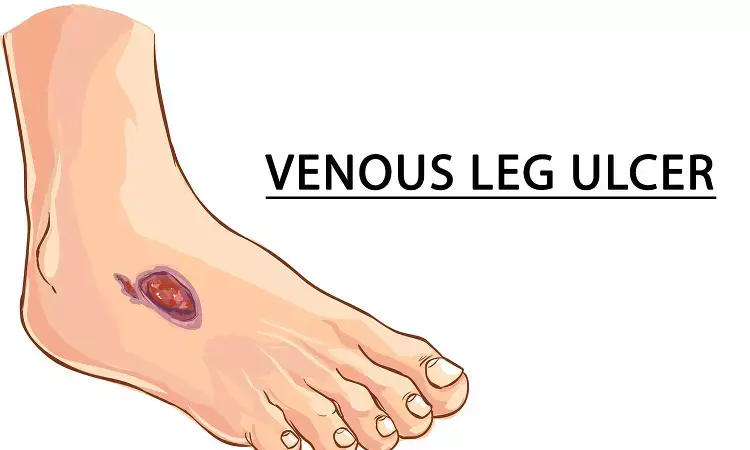 Early surgical interventions linked to faster healing of venous leg ulcers: Study