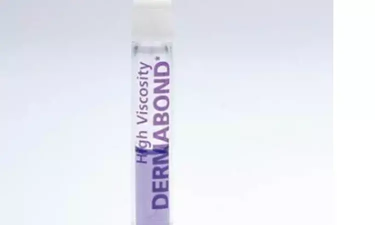 Liquid  skin adhesive Dermabond linked to Allergic contact dermatitis: Study