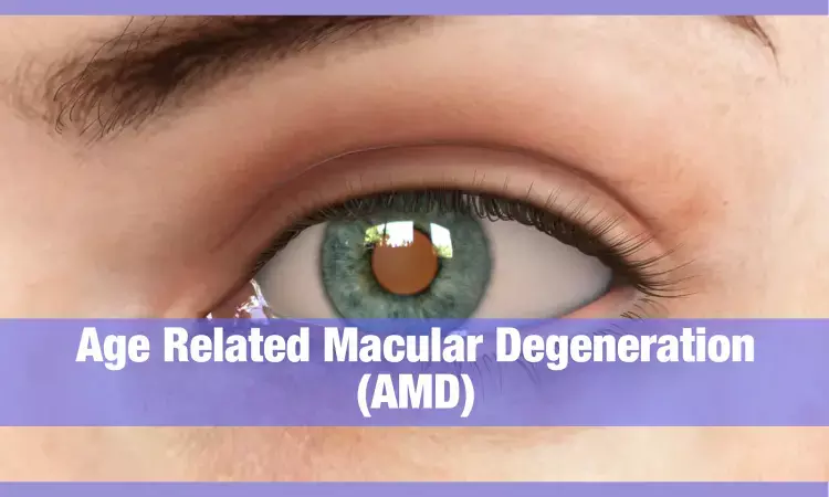 Novel eyedrop is promising wet AMD treatment
