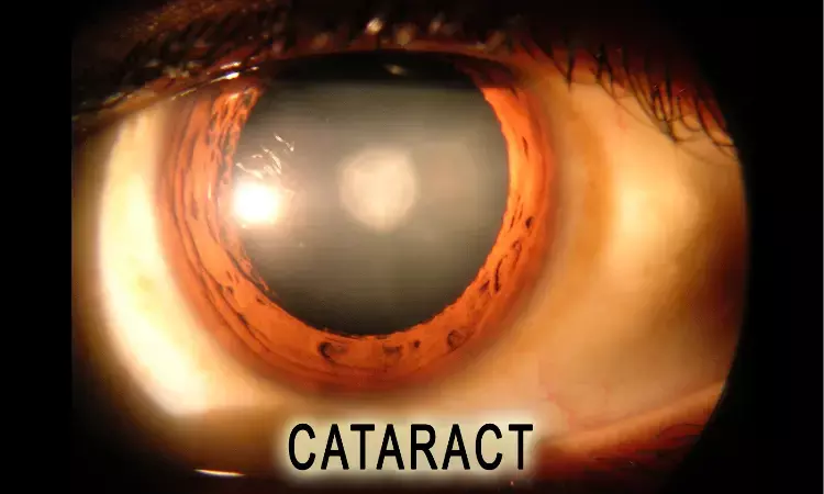 Contrast Sensitivity Function testing may enhance cataract evaluation and surgical decision-making