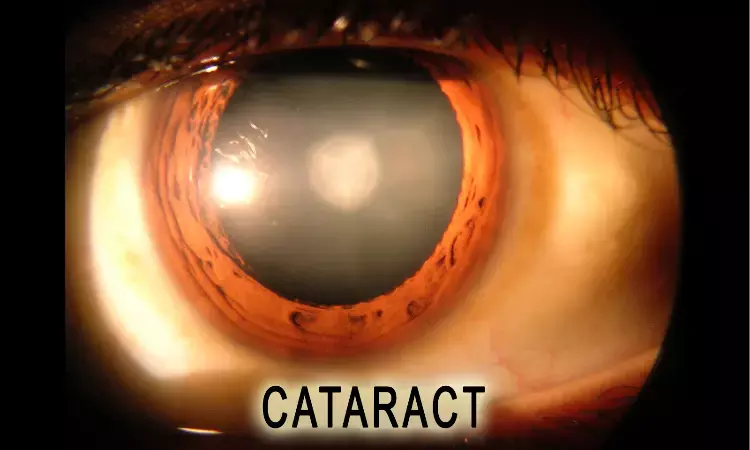 Atopic dermatitis in children linked to increased cataract risk: Study