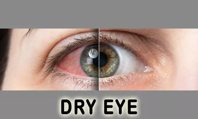 Eysuvis now available for short term treatment of dry eye disease