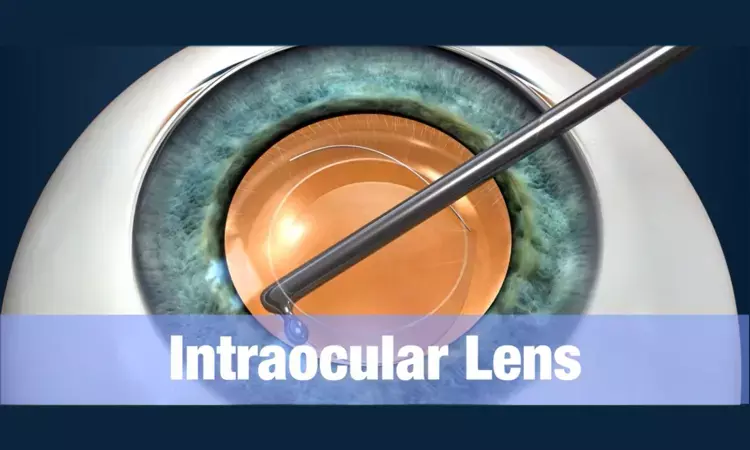 Contralateral Bifocal Intraocular Lenses overall satisfaction significantly greater than Trifocal Intraocular Lenses