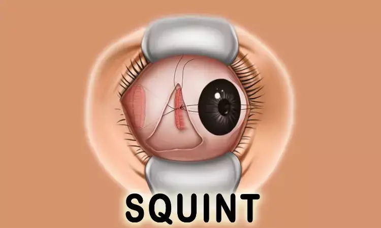 Study Compares Sevoflurane and Propofol for Squint Surgery in Children