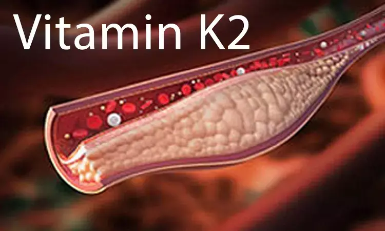 Role of Vitamin K2 in managing vascular calcification: Review