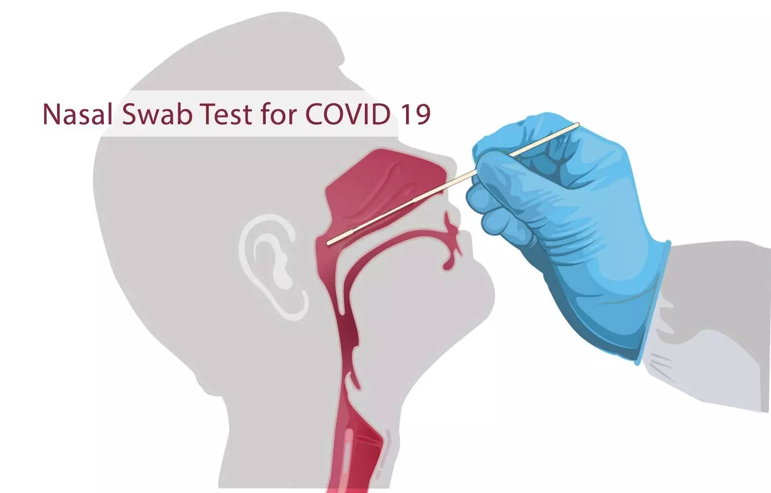 Rare case of Iatrogenic CSF leak after Nasal swab testing for COVID 19 reported
