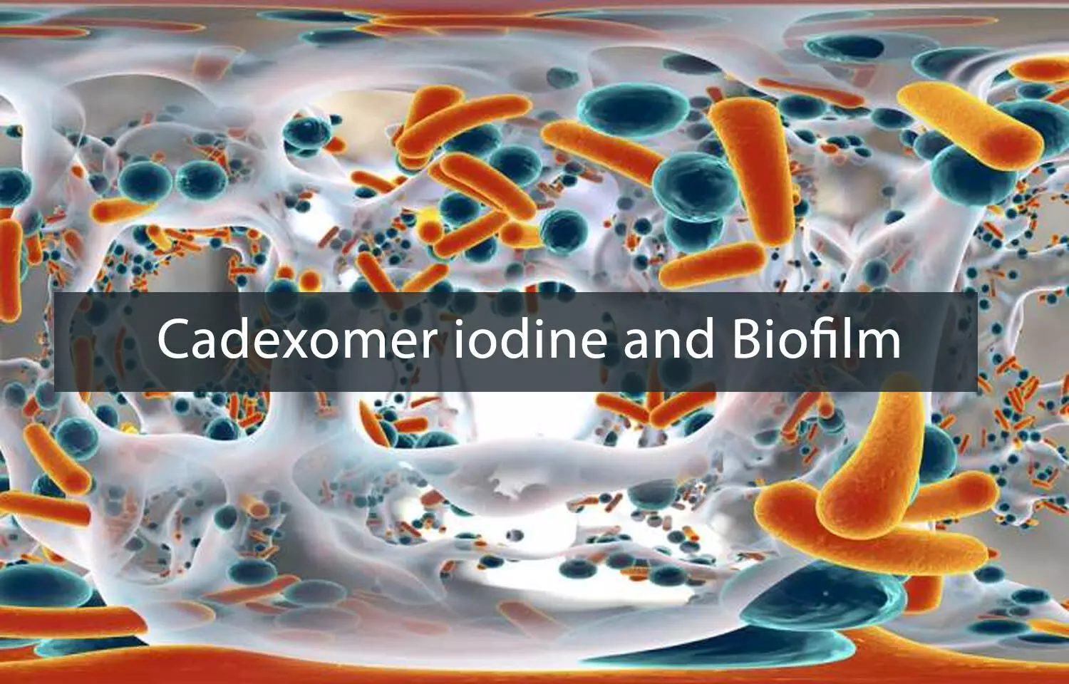 Understanding the efficacy of Cadexomer Iodine in managing Wound Biofilms: Review