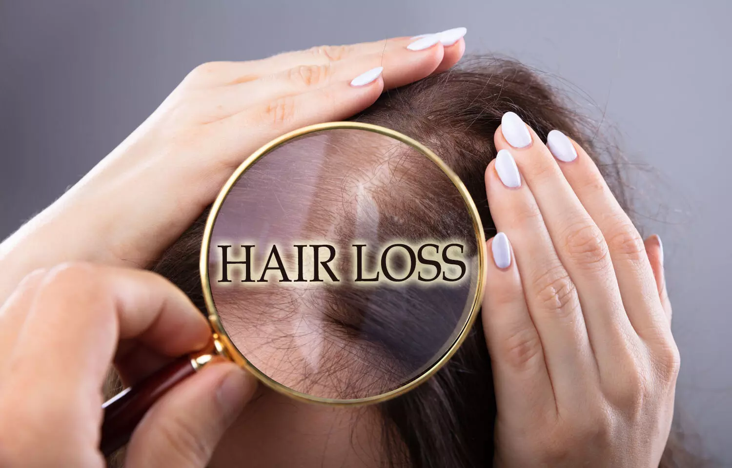 How chronic stress leads to hair loss, finds study